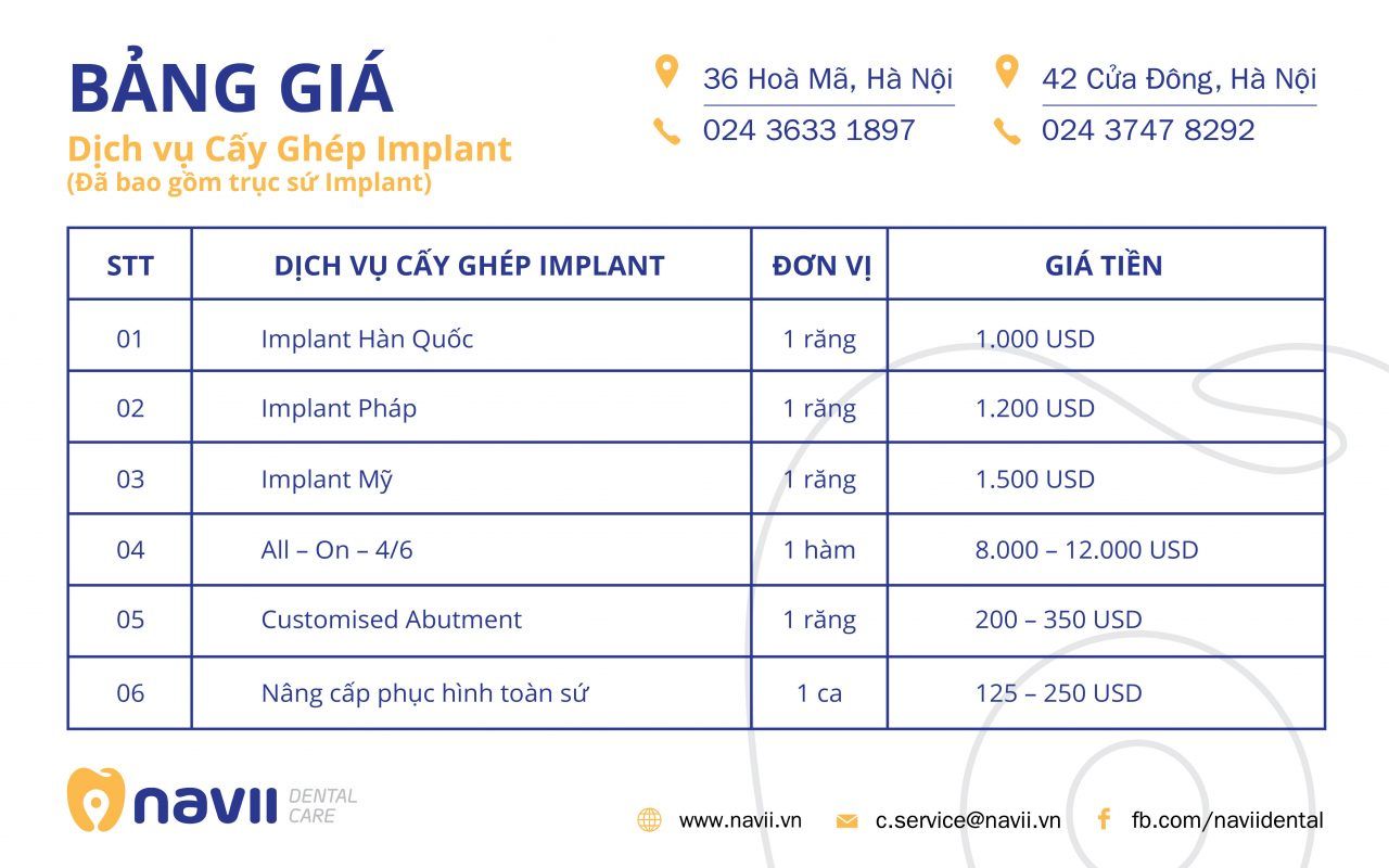 bang-gia-dich-vu-trong-rang-implant