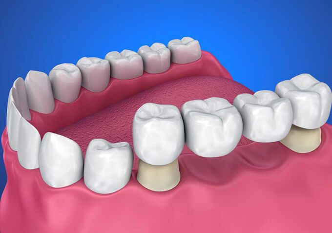 cau-rang-su-porcelain-crow