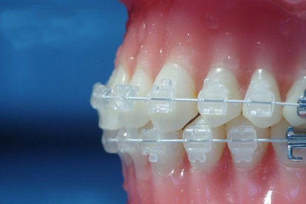 gia-nieng-rang-mac-cai-su-day-trong