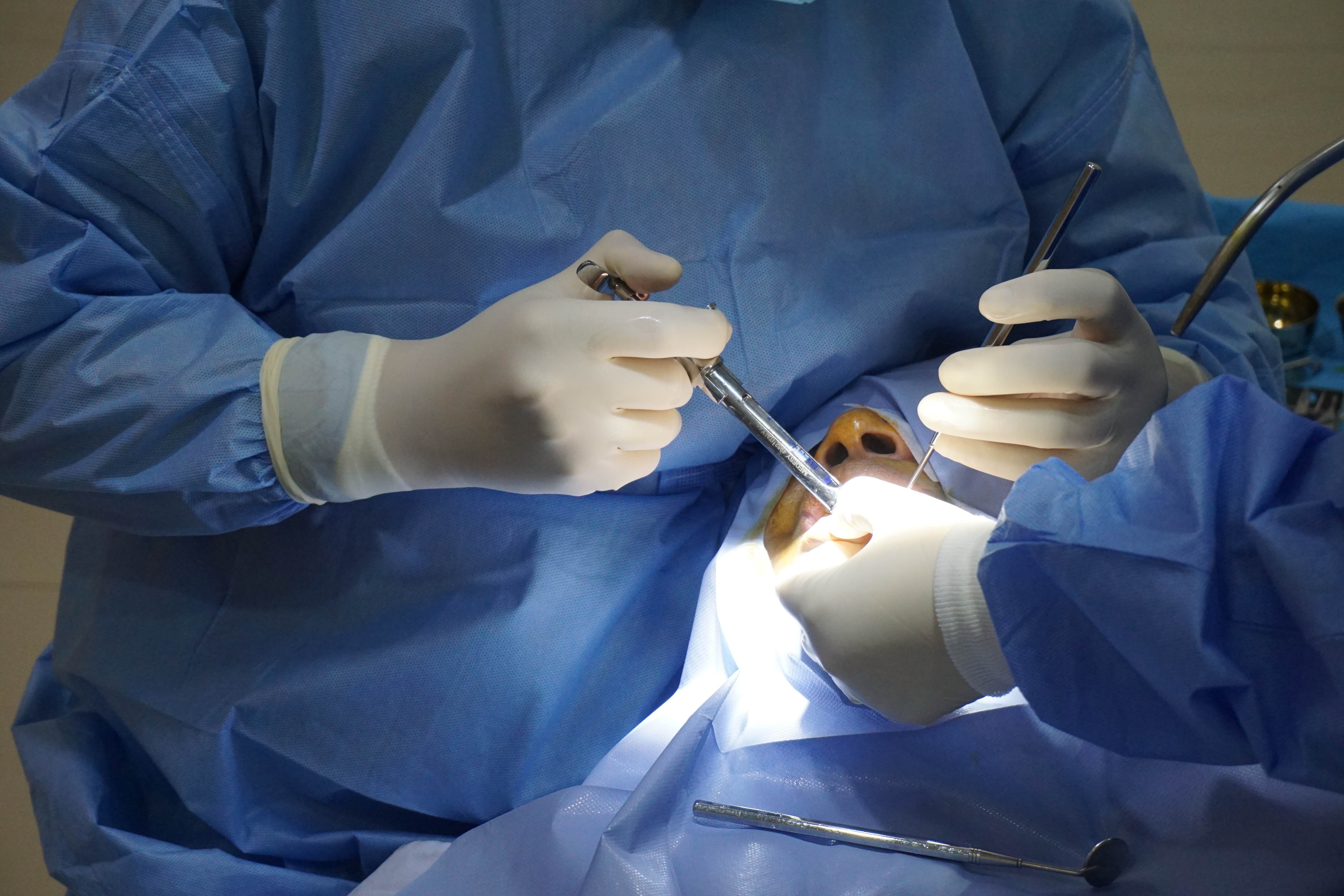 trong-rang-implant-o-dau