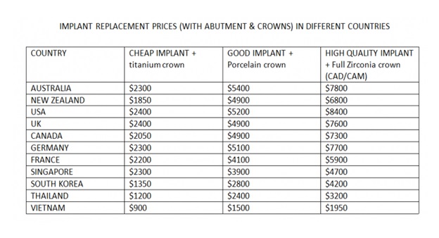 so-sanh-gia-lam-rang-implant