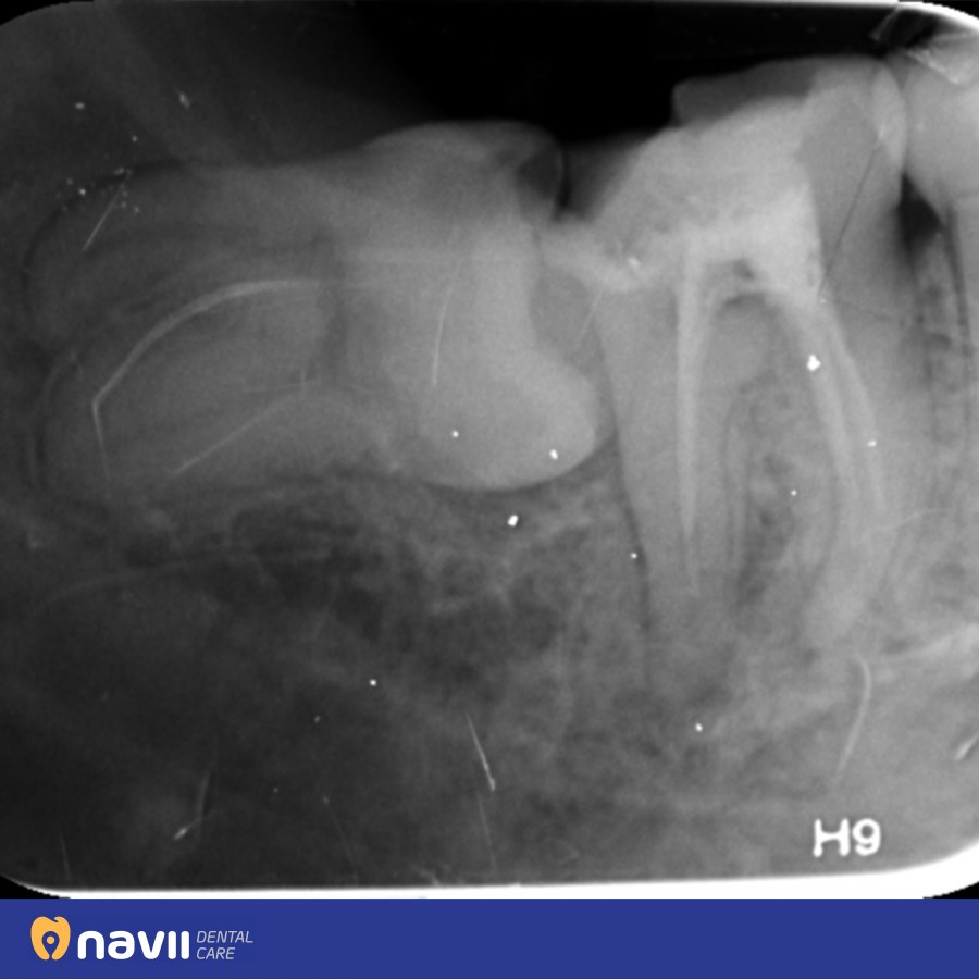 co-nen-nho-rang-so-8