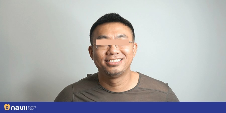 nho-rang-khon-het-bao-nhieu-tien