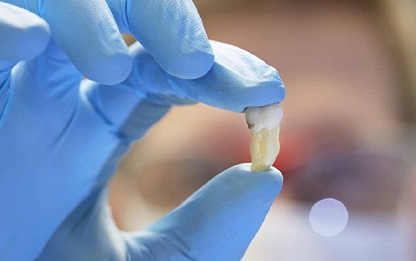 nho-rang-so-8-co-dau-khong