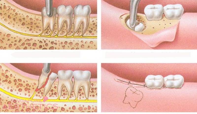 nen-an-gi-sau-nho-rang-khon