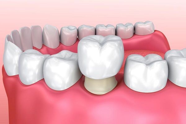 dau-rang-sau-co-nen-nho-khong-3