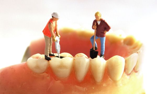 rang-tram-roi-tram-lai-duoc-khong-2