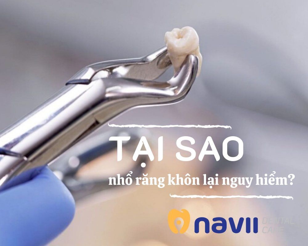 tai-sao-nho-rang-khon-lai-nguy-hiem-1