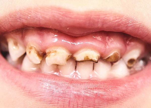 nho-rang-sua-cho-tre-3