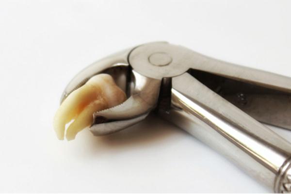 nho-rang-khon-moc-lech