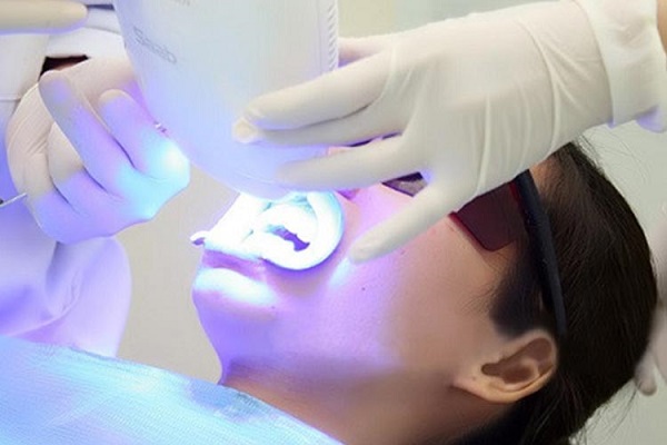 rang-bi-nhiem-mau-khang-sinh-4