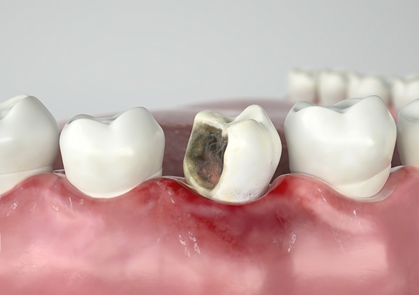 rung-rang-o-nguoi-gia-2