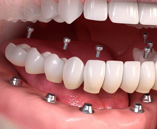 rung-rang-o-nguoi-gia-5