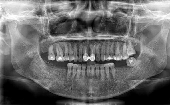 rung-rang-o-nguoi-gia-6