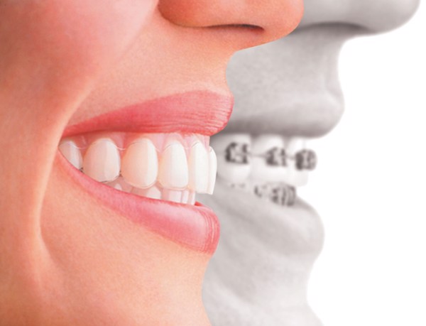 nieng-rang-co-lam-mui-cao-len-1