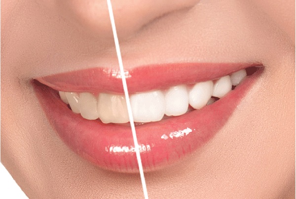 tay-trang-rang-don-tet-2